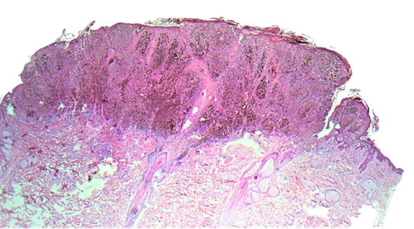 IMI020b.jpg